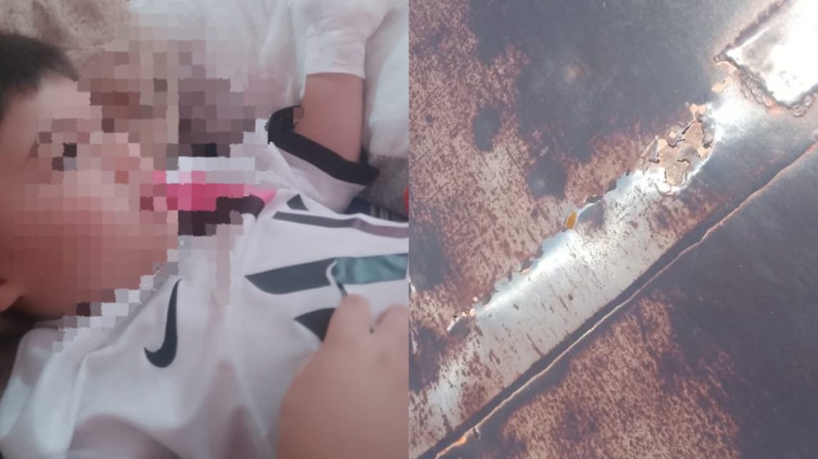 Grave denuncia por el estado de un tobogán en plaza de la zona sur: un niño perdió parte de su dedo