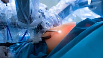 Obesidad y cirugía bariátrica