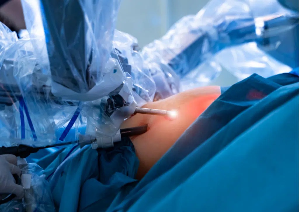 Obesidad y cirugía bariátrica