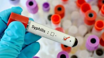 Fuerte salto de sífilis en Argentina: aumentó el 38,5% y se espera un nuevo récord en 2025