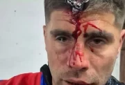 Salvaje ataque a un jugador del Ascenso: le clavaron una llave en la cabeza y terminó con fractura de cráneo