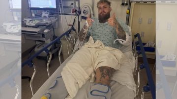 Jake Paul fue operado de urgencia tras el brutal nocaut de Joshua que le fracturó la mandíbula