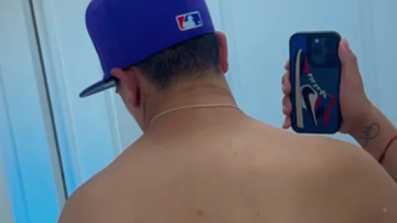 Thiago Medina compartió fotos inéditas de su accidente: “Gracias a estas cicatrices sigo vivo”