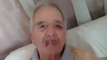 VIDEO | Filmaron una brutal agresión a un jubilado en un geriátrico de Mar del Plata