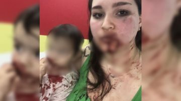 Búsqueda urgente de un agresor que atacó a su pareja y a su hija de 17 meses