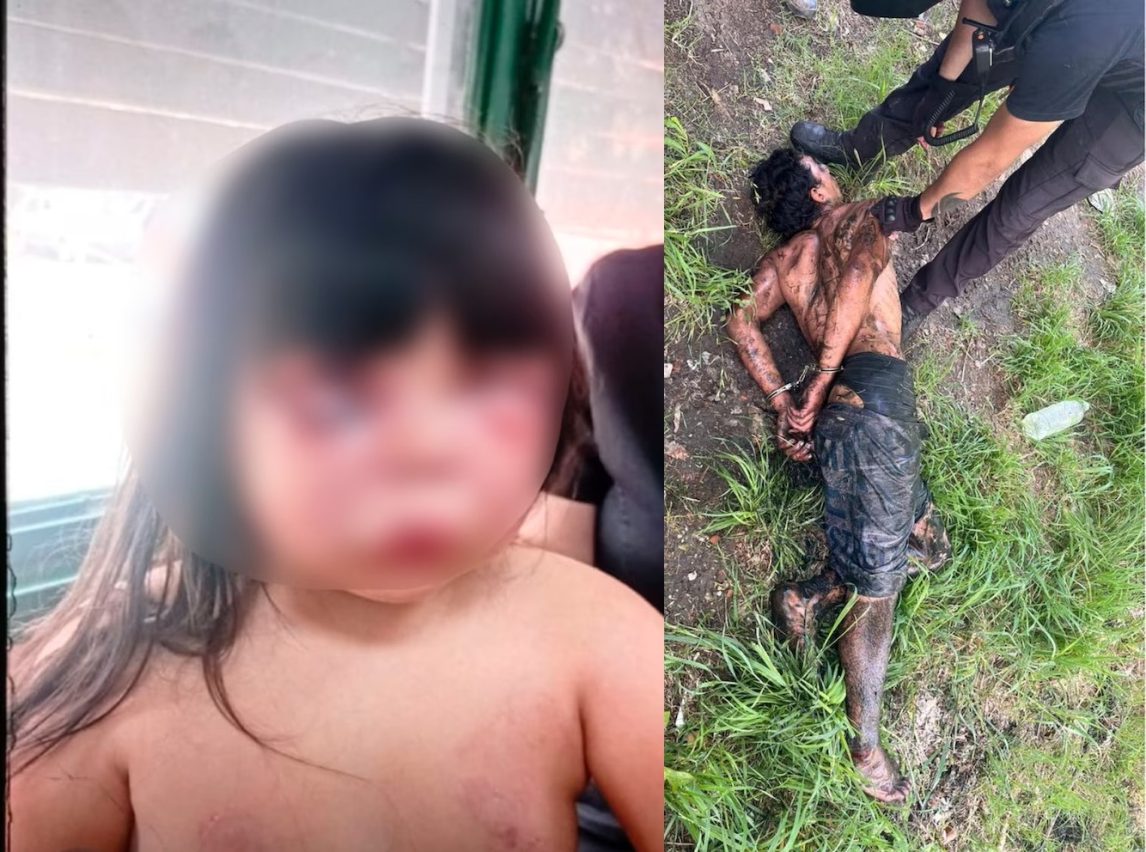 Desfiguró a golpes a una nena de 7 años y atacó a la madre; los vecinos casi lo linchan
