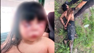 Desfiguró a golpes a una nena de 7 años y atacó a la madre; los vecinos casi lo linchan