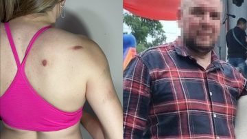  “Me agredió con golpes y trompadas delante de mis hijos”: terrible denuncia de una mamá contra su ex