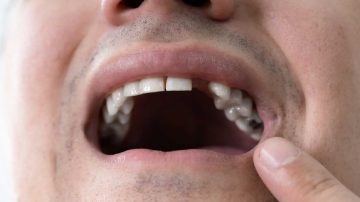 Gresca sangrienta en Nueva Esperanza: un hombre terminó con un diente menos