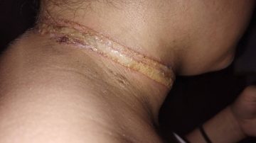 Conmoción: motociclista se enganchó en un cable suelto de la vía pública y casi muere ahorcada