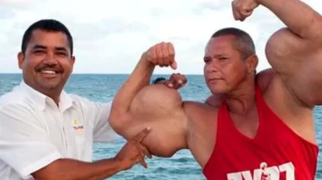 Murió el “Popeye brasileño”: el fisicoculturista que se inyectaba aceite para aumentar sus bíceps