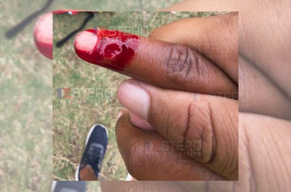 Menores se bañaban en una zona prohibida y a uno lo atacó una palometa