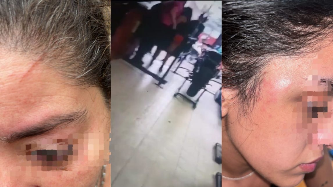 Una más y van… denuncian a Sebastián Corti por agresión a su actual pareja