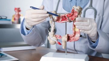 Qué es el Petosemtamab y por qué aseguran que podría frenar la metástasis en el cáncer de colon