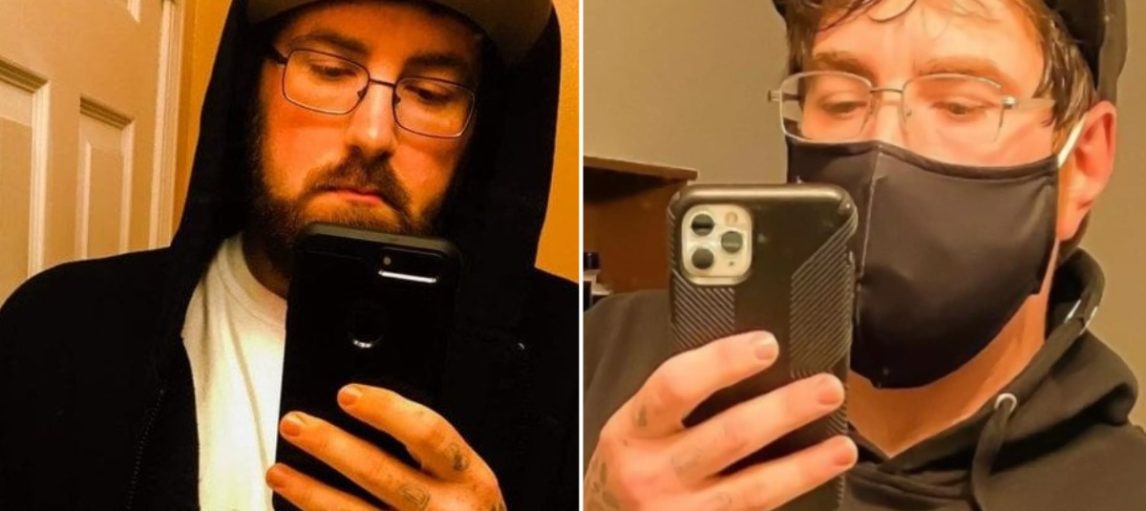 Un hombre quiere entrar en el Guinness por tener el “pene más pequeño” del mundo