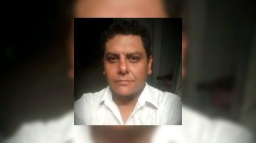 Lanzan una rifa solidaria para cubrir una cirugía urgente por insuficiencia venosa