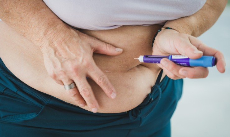 Cirugía bariátrica vs semaglutida: estudios previos y seguridad operatoria