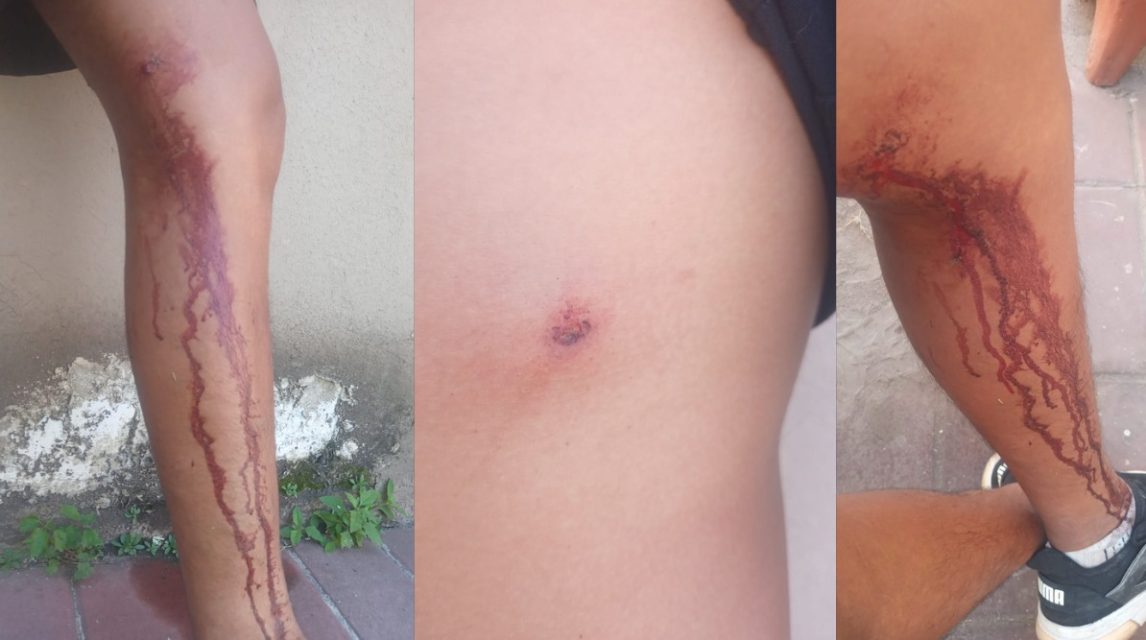 Violencia en Villa Nueva: la madre de los hermanos Castro dio su versión y negó un intento de robo