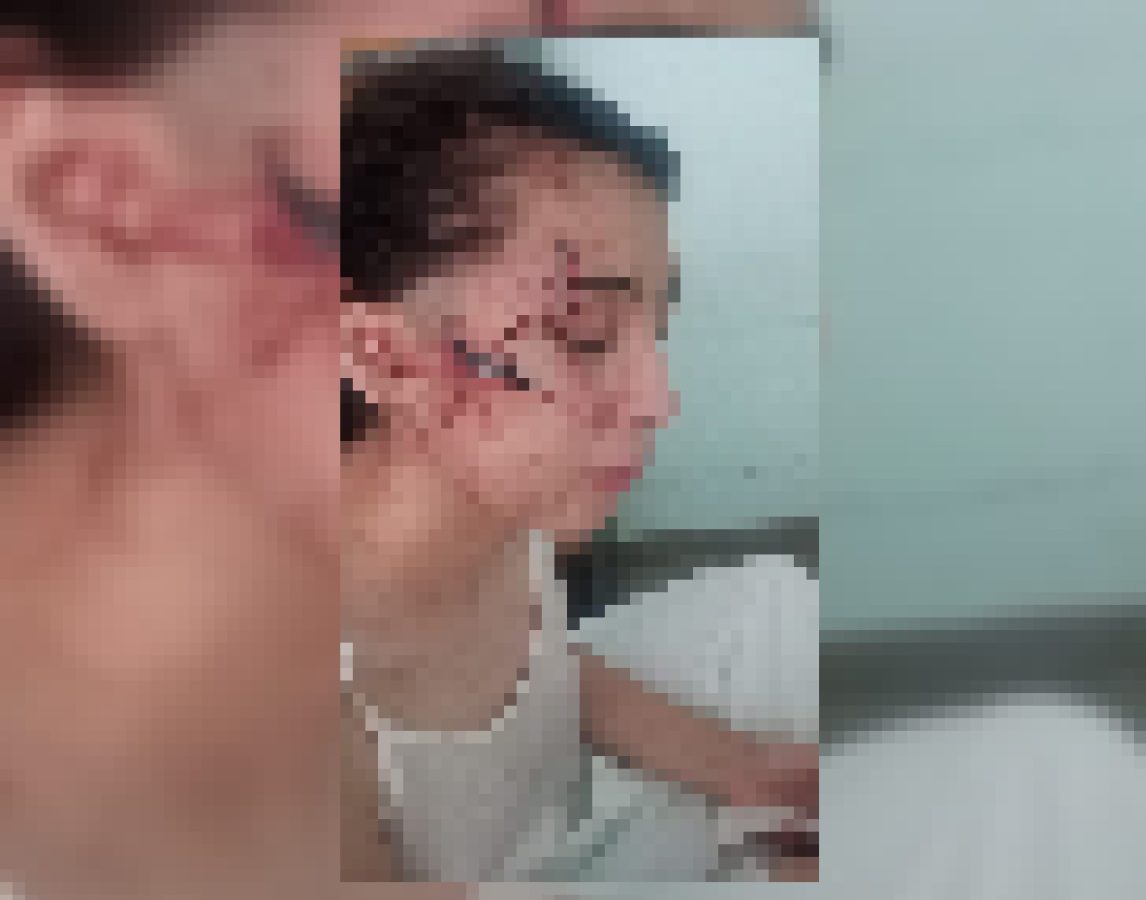 Violencia extrema: una adolescente fue brutalmente herida tras meses de hostigamiento en redes sociales