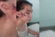 Violencia extrema: una adolescente fue brutalmente herida tras meses de hostigamiento en redes sociales
