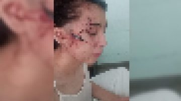 Violencia extrema: una adolescente fue brutalmente herida tras meses de hostigamiento en redes sociales