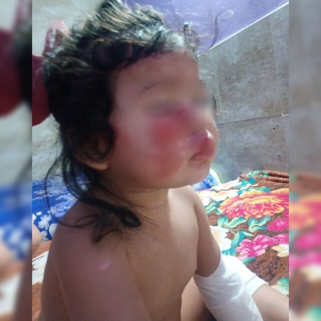 “No tienen piedad”: Una mamá mostró cómo quedó su beba luego de que las asaltaran