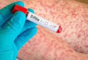Alerta sanitaria: los casos de sífilis subieron un 71% y alcanzan su cifra más alta en cinco años