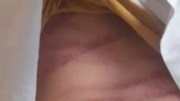 Un adolescente de 14 años se presentó en la comisaría y denunció que su padrastro lo golpeó con una manguera