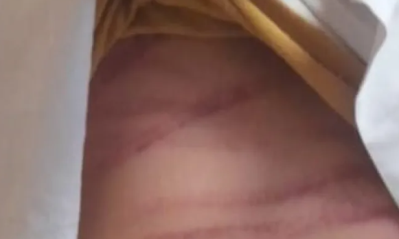 Un adolescente de 14 años se presentó en la comisaría y denunció que su padrastro lo golpeó con una manguera