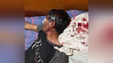 Un hombre recibió 10 puntos de sutura tras recibir un ladrillazo en la cabeza durante una pelea