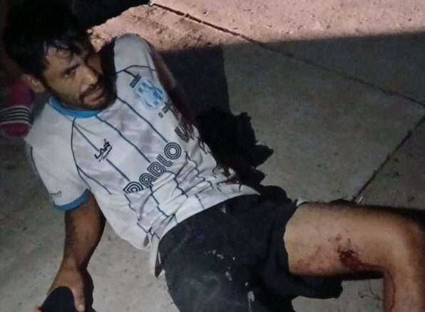 B° Río Dulce: un hombre fue atacado a balazos por su suegro