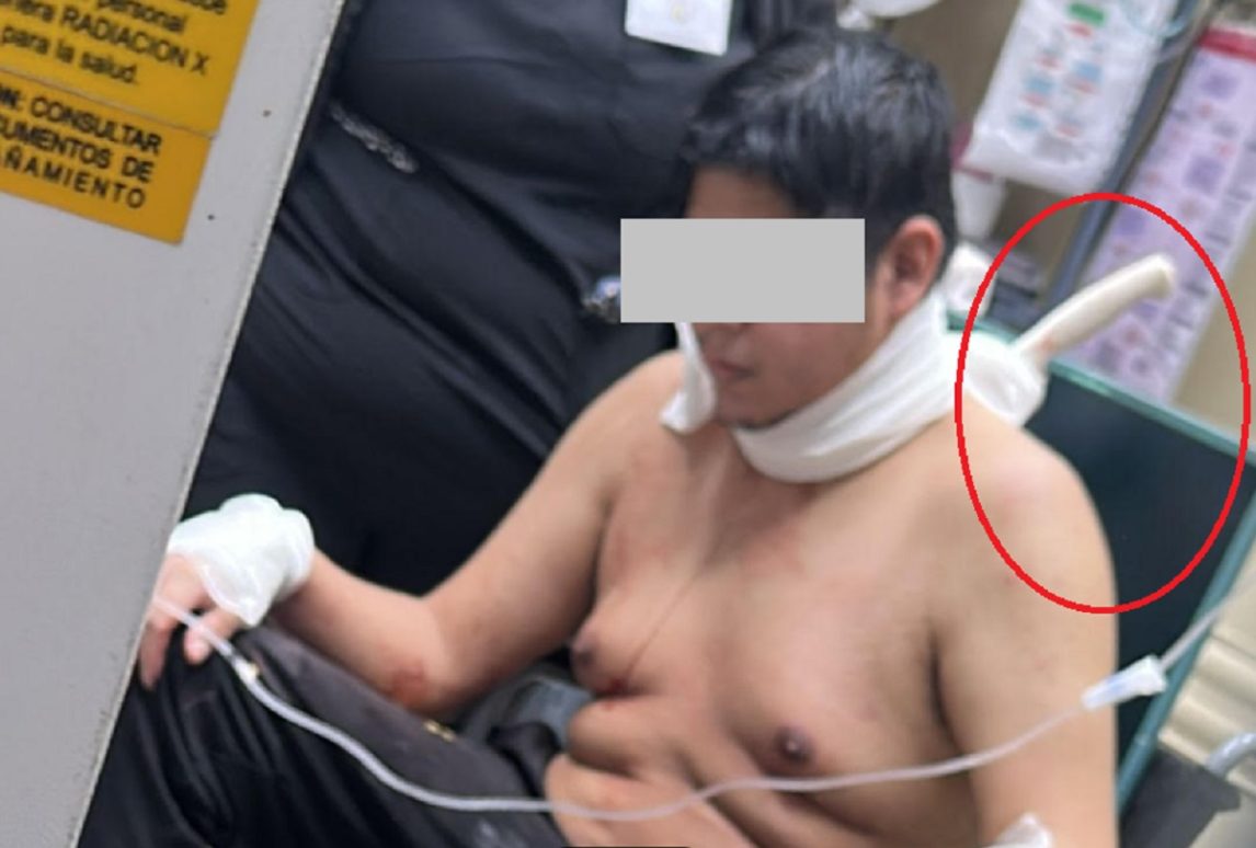 La Banda: llegó al hospital con un cuchillo incrustado en la columna tras un violento intento de robo