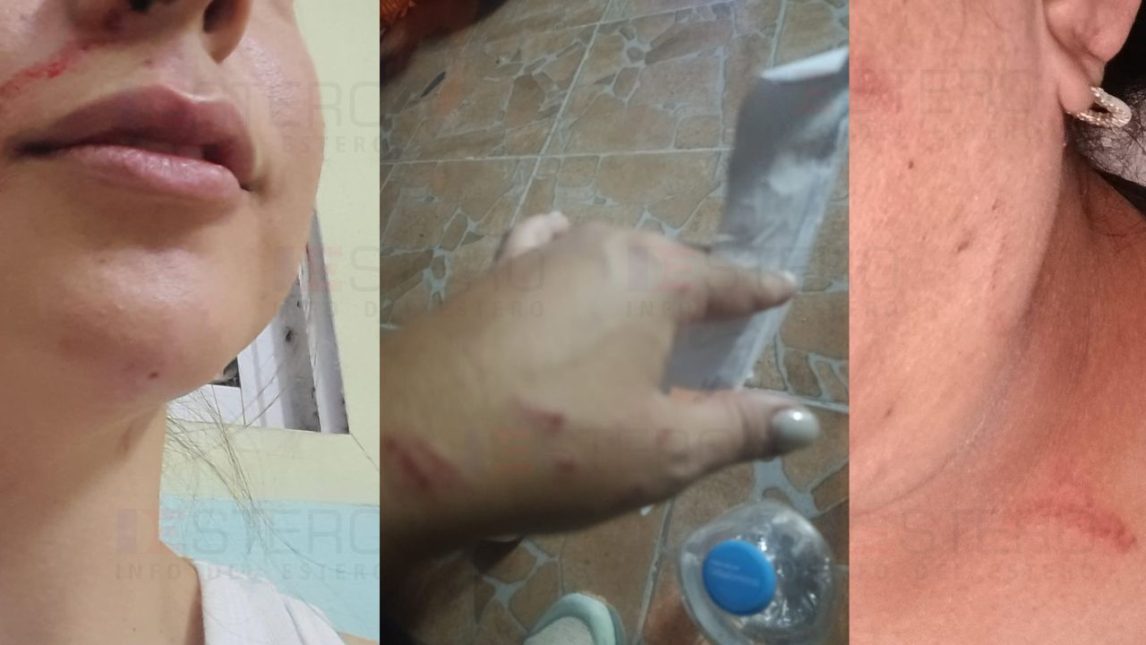 Mujer acusada de agredir a una vendedora en el B° Ejército Argentino dio su versión: “Me acusa de que yo la golpeé cuando no me metí en la pelea”