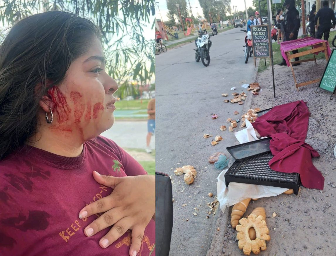 “Fueron directamente a pegarme”: Crudo relato de la vendedora agredida en el B° Ejército Argentino