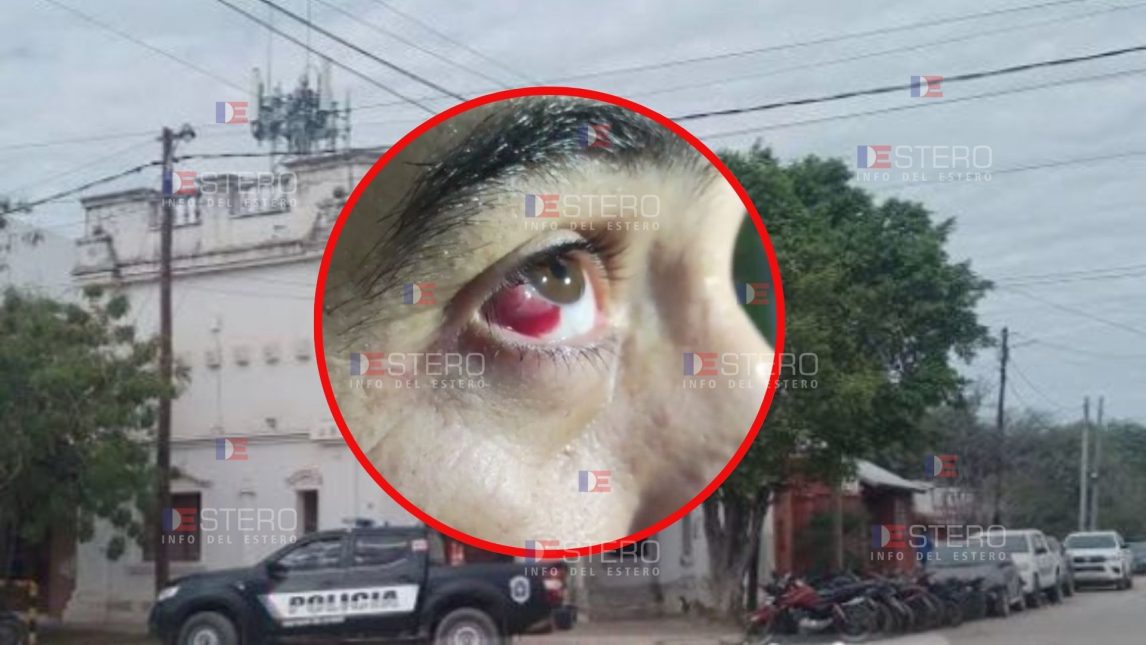 Añatuya: atacaron en patota a un camionero que reclamó por un robo