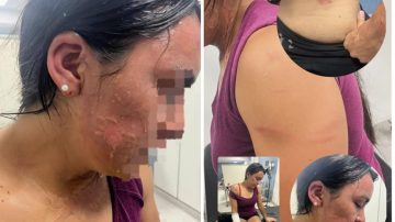 Atacaron a la hermana del influencer Jorgito Barrionuevo: la golpearon y le tiraron agua hervida