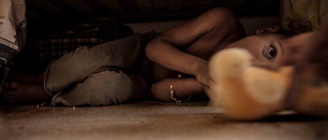 Denunció a su nuera luego de que su nieta apareciera con lesiones en el ojo, la frente y la pierna