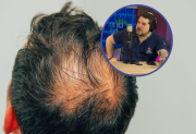Dr. Federigi Chaud “Cuando el pelo se cae, nada lo hará volver a crecer; no hay producto o masaje milagroso”