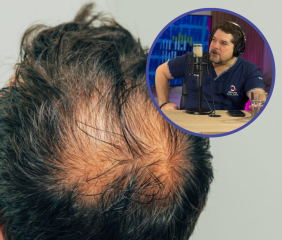 Dr. Federigi Chaud “Cuando el pelo se cae, nada lo hará volver a crecer; no hay producto o masaje milagroso”