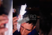 Barrio Siglo XXI: lo atacaron entre tres y lo machetearon en la cabeza