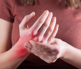 “Podemos tener lupus sin saberlo”: alertan sobre la falta de diagnóstico y visibilización de esta dolorosa enfermedad