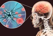 Alerta epidemiológica: los casos de meningitis superan los valores habituales en el país
