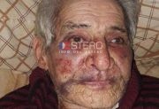 “Mi padre no quiere hablar, no quiere comer”: crítica situación del vecino termeño atacado en un robo