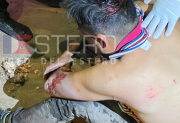 Un hombre fue atacado a machetazos en La Banda