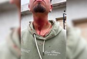 Barrio Siglo XIX: discutió con su pareja y se provocó cortes en el cuello