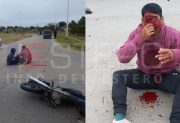 Motociclista terminó con el rostro desfigurado tras un fuerte choque en avenida Solís y Circunvalación