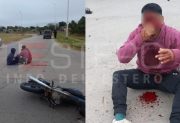 Motociclista terminó con el rostro desfigurado tras un fuerte choque en avenida Solís y Circunvalación