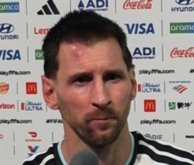 El llamativo chichón de Messi tras el triunfo de Argentina ante Cabo Verde: ¿qué le pasó?