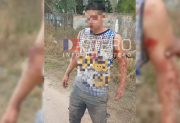 Un hincha de Atlético Frías fue herido con bala de goma: la familia denuncia a la Policía