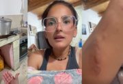 “Casi hago explotar la cocina”: el dramático relato de una influencer de La Banda tras un accidente con una garrafa